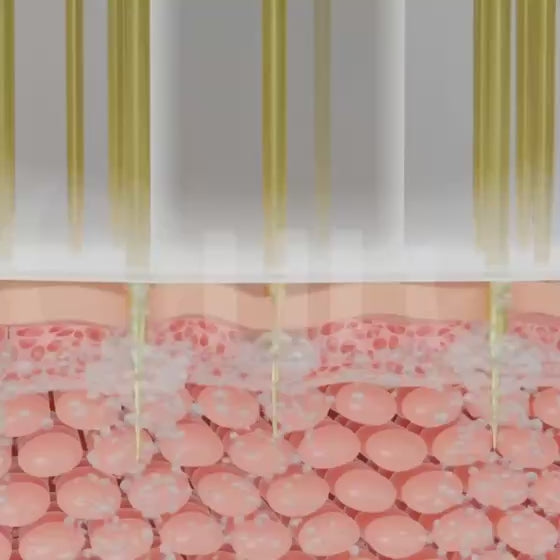 Charger la vidéo : 